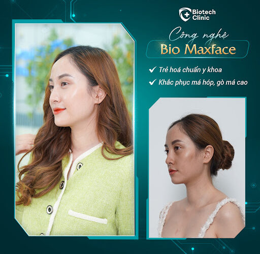 Hình ảnh khác biệt rõ rệt trước và sau khi chị Mai thực hiện công nghệ Mô sinh học Bio MaxFace